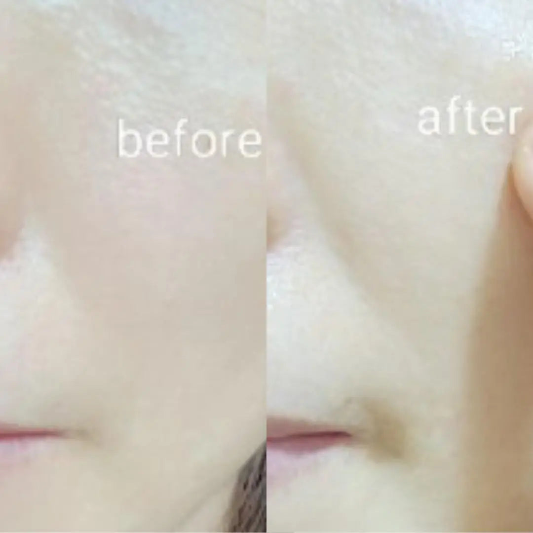 The Chila Irish – Purifying & Moisturizing Sheet Mask